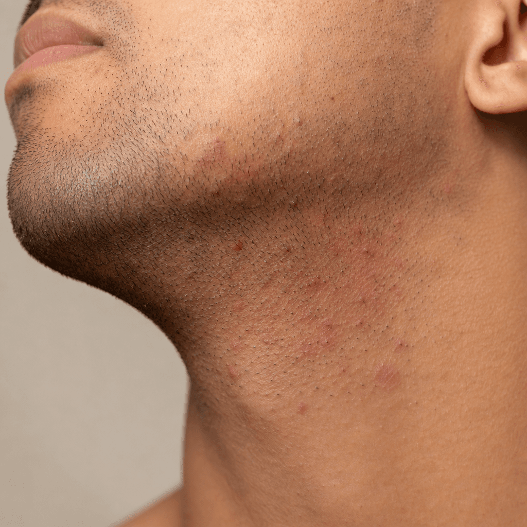 Shaving bumps closeup